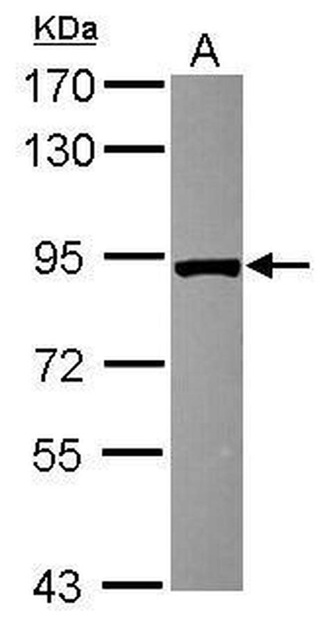 Vps35 Polyclonal Antibody Pa5 30654