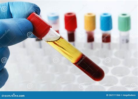 Lab Technician Holding A Test Tube Of Blood Sample After Being