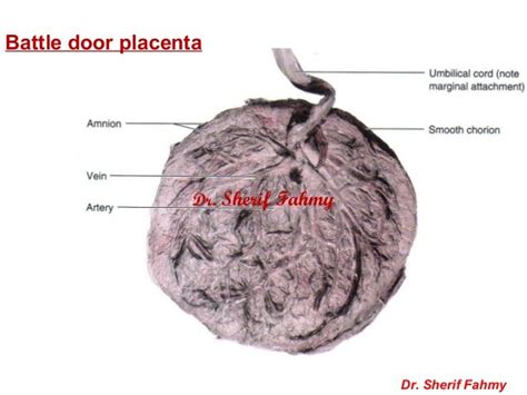 Placenta And Amnion General Embryology