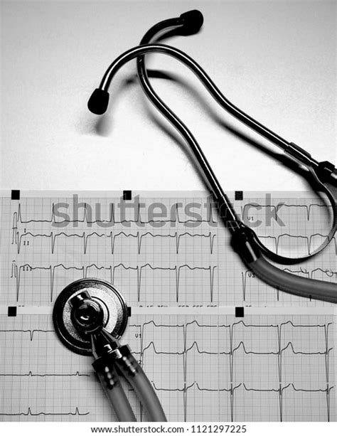 Healthy Concept Stethoscope Electrocardiogram Ecg Ekg Stock Photo