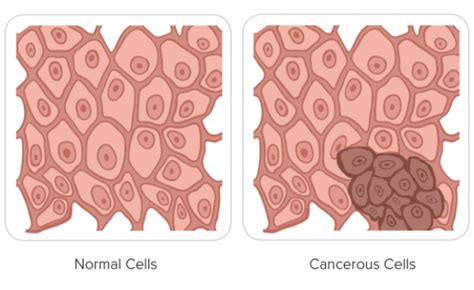 Cancer Cell Types