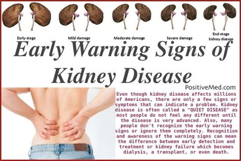11 Kidney Damage Symptoms Most People Ignore Kidney Disease Warning