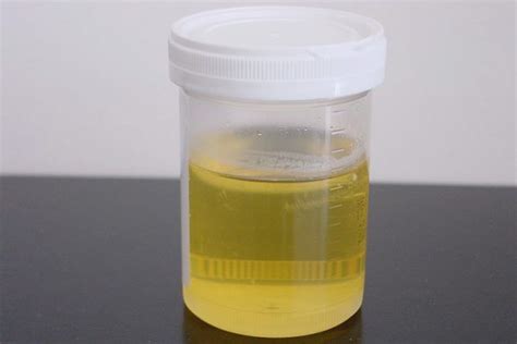 Foamy Urine Causes And Remedies