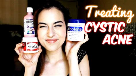 Best Home Treatment For Cystic Acne Treat Choices