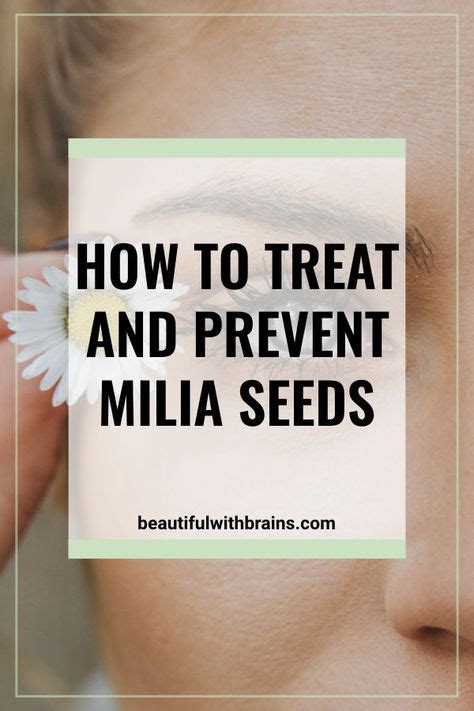 How To Prevent And Treat Milia Seeds Skin Care Secrets Clear Skin