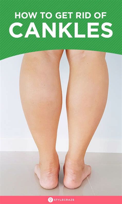 How To Get Rid Of Cankles Diet And 6 Best Exercises