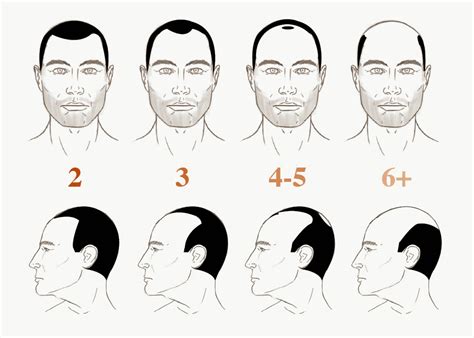 Your hair might begin to thin at. HOW BALD ARE YOU? ~ THE MALE GROOMING REVIEW