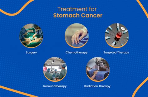 Stomach Cancer Treatment Everything You Need To Know