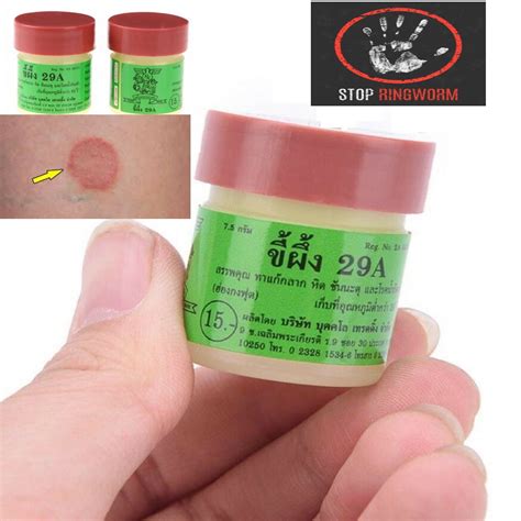 Ringworm Treatment Herbal And Natural Ointment Relieves Itching 29a