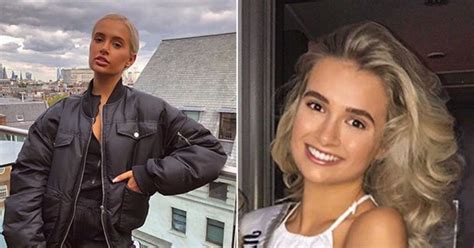 Molly Maes Mega Transformation Dissected By Cosmetic Doctor Amid