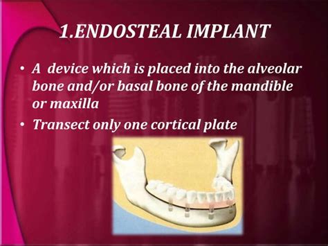 Types And Classification Of Dental Implants Ppt