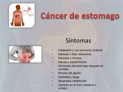 Tumor Estomago Sintomas Seo Positivo