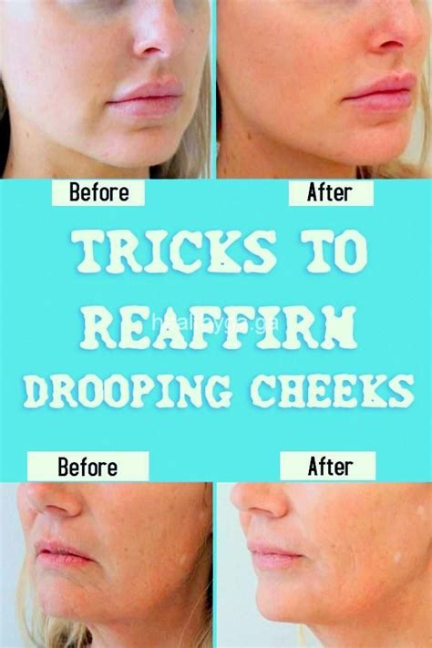 Tricks To Reaffirm Drooping Cheeks With Images Health Routine