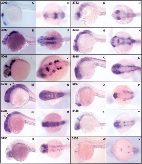 A Gene Expression Screen In Zebrafish Embryogenesis