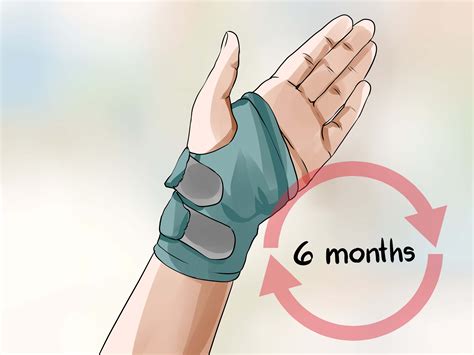 How To Treat Carpal Tunnel Syndrome 11 Steps With Pictures