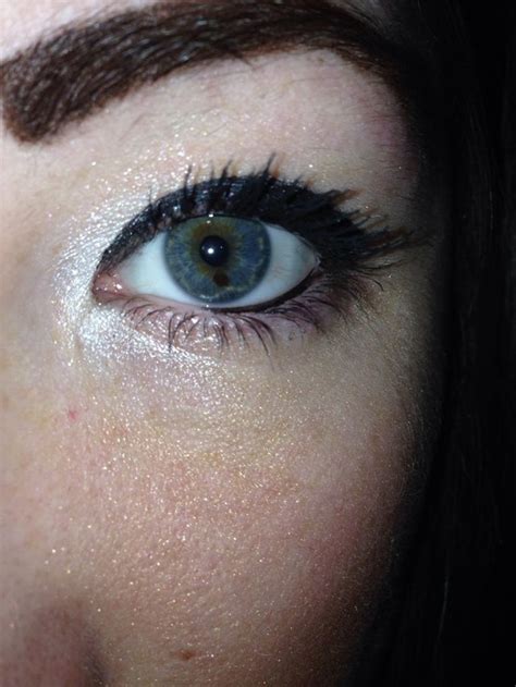 Eye Freckle Rmildyinteresting