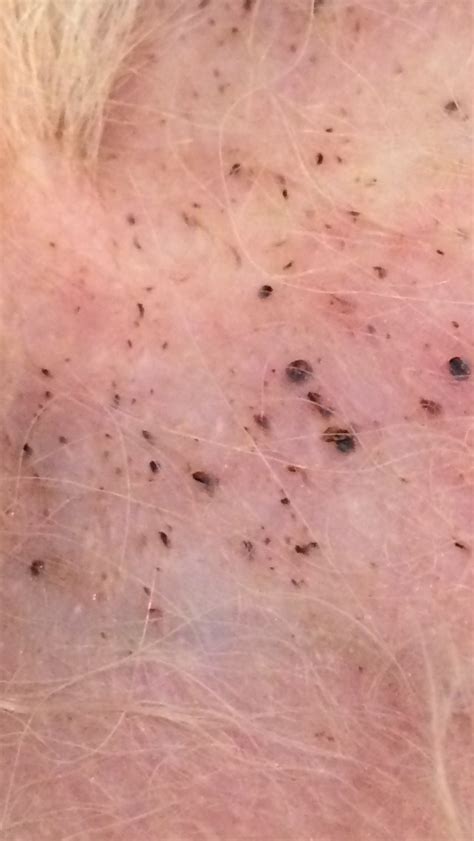 Black Spots On Dogs Skin