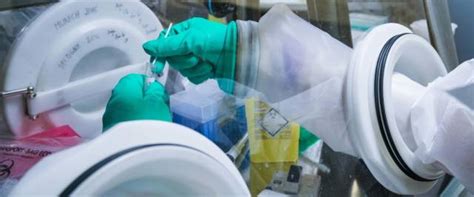 Esto implica que lambda está circulando a tasas similares a la variante brasileña gamma (33%) y mientras que argentina informó una prevalencia creciente de lambda desde la tercera semana de. Spunta la variante Lambda, individuata in Perù. L'Oms: una ...