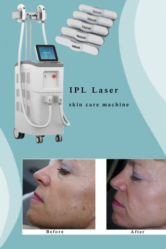 Professional Ipl Photofacial Machine For Skin Rejuvenation Bestview