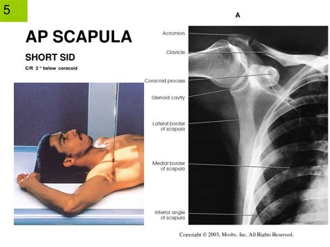 Ppt Shoulder Ch 6 And Bony Thorax Ch 9 Part 3 Scapula Sternum Ribs