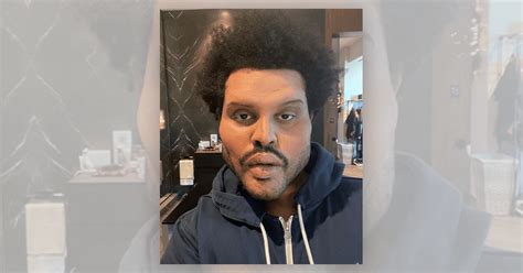 The weeknd was among the performers at the billboard music awards sunday night (may 23). Did The Weeknd Get Plastic Surgery? | Fact Check from ...