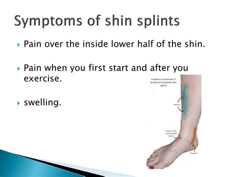 Ppt Shin Splints Powerpoint Presentation Free Download Id2121161