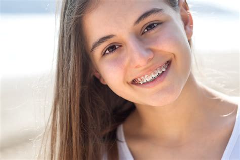 Braces Side Effects And Problems Tony Weir Orthodontics