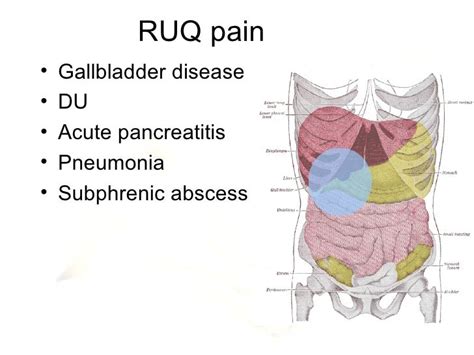 Right Upper Quadrant Abdominal Pain Causes