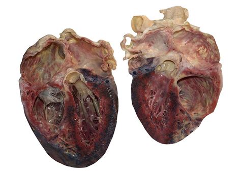 Pngkit selects 31 hd real heart png images for free download. Dissected Human Heart Photograph by Victor Habbick Visions