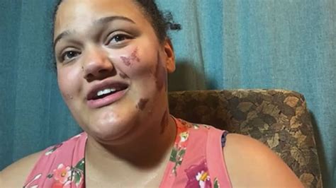 Assault On 18 Year Old Biracial Woman In Wisconsin Being Investigated