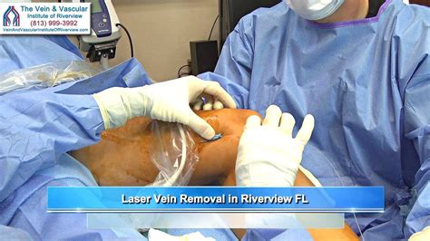 Pin On Varicose Vein Treatment Riverview Fl