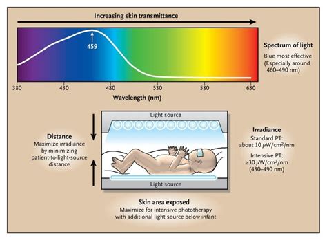Phototherapy for Neonatal Jaundice  NEJM