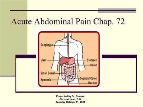 Ppt Acute Abdominal Pain Chap 72 Powerpoint Presentation Free