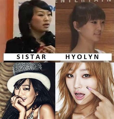 Kpop Female Idols Before And After Plastic Surgery Kpop Female Idols