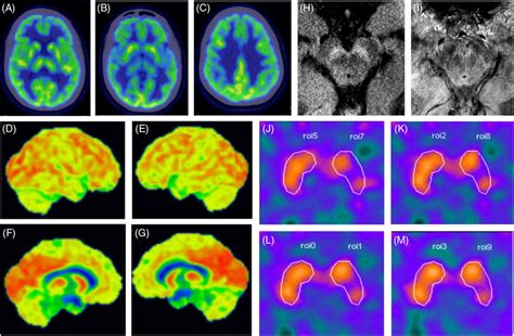 Comprehensive Neuroimaging Ancillary Evaluation Download