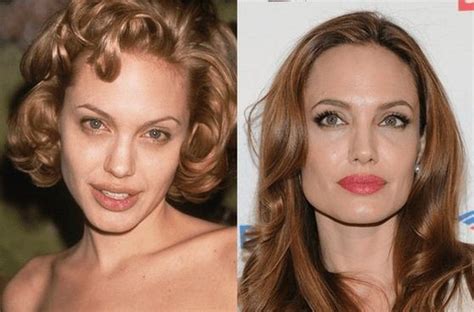 Judging by these before and after pics photoshop is celebrities' best friend. Angelina Jolie before and after plastic surgery 04 ...