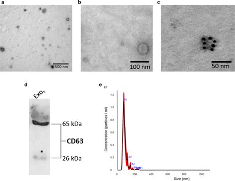 Characterization Of Exosomes Purified From The Serum Of Crps Patients