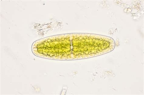 Netrium Oblongum The Microscopic Life Of Shetland Lochs