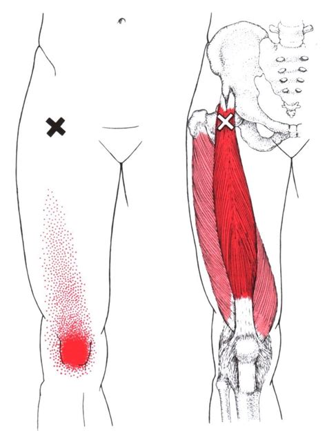 Human muscle system, the muscles of the human body that work the skeletal system, that are under voluntary control, and that are concerned with movement, posture, and balance. Rectus Femoris Trigger Point Diagram | Триггерные точки ...