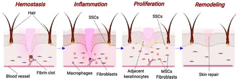 Phases Of Skin Wound Healing Process Hemostasis Activation Of Fibrin