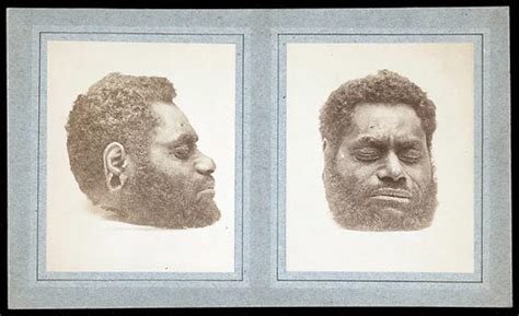 The Decapitated Head Of A Man Two Views Free Public Domain Image