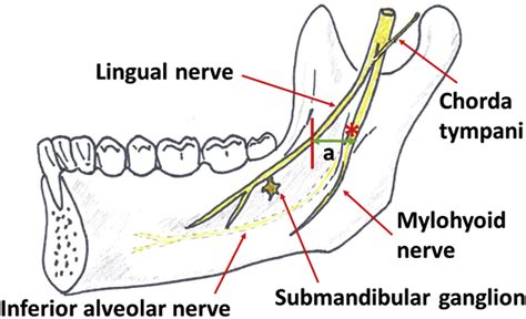 Clinical Anatomy Of The Lingual Nerve A Review Journal Of Oral And Maxillofacial Surgery
