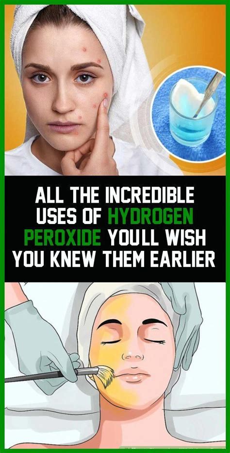 Mix a 50/50 solution with water, swoosh around mouth. All The Incredible Uses Of Hydrogen Peroxide- You`ll Wish ...