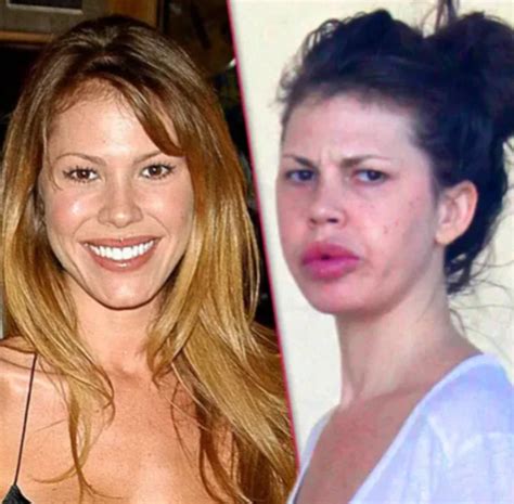 Nikki Cox Plastic Surgery Unveiling The Truth Behind Her Transformation