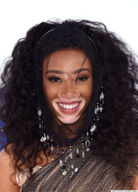Winnie Harlow Proves Shes The Model Of The Moment At The 2016 Mtv Vmas