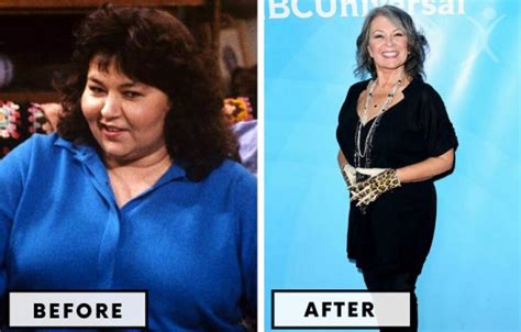 Top 21 Celebrity Bariatric Surgery Transformations