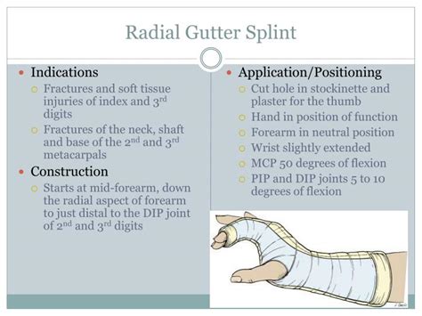 Distal Radial Fracture Splint
