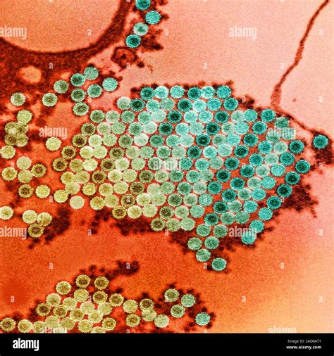 Las Partículas Del Virus Chikungunya Micrógrafo Electrónico De