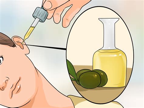 3 Ways To Treat A Fungal Ear Infection Wikihow