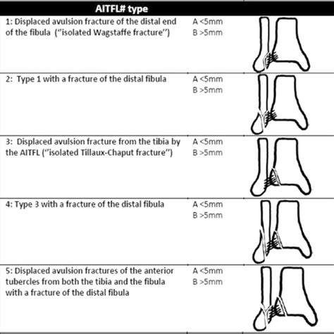 Modified Aitfl Avulsion Fracture Classification System Download
